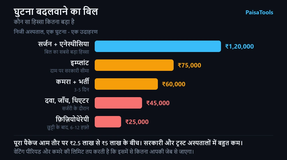 एक घुटने की सर्जरी का बिल हिस्सों में बँटा हुआ - सर्जन की फ़ीस, इम्प्लांट, कमरा और भर्ती, दवा-जाँच, और छुट्टी के बाद की फ़िज़ियोथेरेपी।